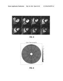 Systems and Methods for Three-Dimensional Spiral Perfusion Imaging diagram and image