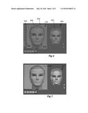 Gesture-Based Editing of 3D Models for Hair Transplantation Applications diagram and image