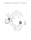 SYSTEMS AND METHODS FOR COORDINATING MUSCULOSKELETAL AND CARDIOVASCULAR OR     CEREBROVASCULAR HEMODYNAMICS diagram and image