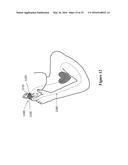 SYSTEMS AND METHODS FOR COORDINATING MUSCULOSKELETAL AND CARDIOVASCULAR OR     CEREBROVASCULAR HEMODYNAMICS diagram and image