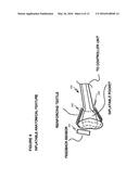 Device and Method for a Medical Simulator With Anatomically Accurate     Inflatable Features diagram and image