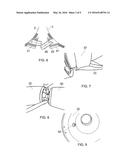 METHOD OF ASSEMBLING A TRANSFORMER diagram and image