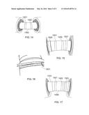 METHOD OF ASSEMBLING A TRANSFORMER diagram and image