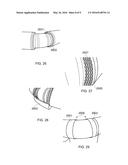 METHOD OF ASSEMBLING A TRANSFORMER diagram and image