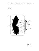 FRONT-PIVOT, MOTORIZED PAN-TILT CAMERA diagram and image