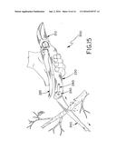 Handheld Pruning Tool diagram and image