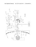 METHOD AND SYSTEM FOR EYE MEASUREMENTS AND CATARACT SURGERY PLANNING USING     VECTOR FUNCTION DERIVED FROM PRIOR SURGERIES diagram and image