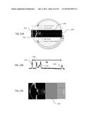 METHOD AND SYSTEM FOR EYE MEASUREMENTS AND CATARACT SURGERY PLANNING USING     VECTOR FUNCTION DERIVED FROM PRIOR SURGERIES diagram and image