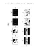 DIAGNOSIS SUPPORTING DEVICE AND METHOD OF SUPPORTING DIAGNOSIS diagram and image