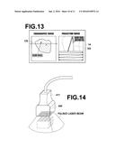 PHOTOACOUSTIC IMAGING METHOD AND PHOTOACOUSTIC IMAGING APPARATUS diagram and image