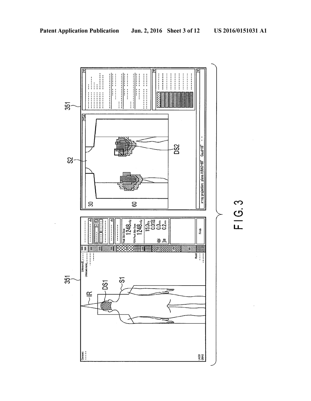 DOSE DISTRIBUTION DISPLAY APPARATUS AND AN X-RAY DIAGNOSTIC APPARATUS - diagram, schematic, and image 04