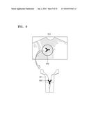 ULTRASOUND IMAGE APPARATUS AND METHOD OF OPERATING THE SAME diagram and image