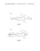 CLOSURE DEVICES, SYSTEMS, AND METHODS diagram and image