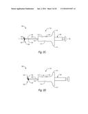 CLOSURE DEVICES, SYSTEMS, AND METHODS diagram and image