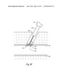 CLOSURE DEVICES, SYSTEMS, AND METHODS diagram and image