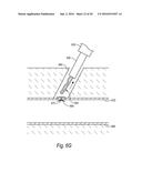 CLOSURE DEVICES, SYSTEMS, AND METHODS diagram and image