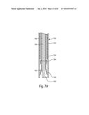 CLOSURE DEVICES, SYSTEMS, AND METHODS diagram and image