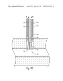 CLOSURE DEVICES, SYSTEMS, AND METHODS diagram and image