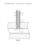 CLOSURE DEVICES, SYSTEMS, AND METHODS diagram and image