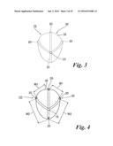 BODY CAVITY FOREIGN MATTER CAPTURE INSTRUMENT diagram and image