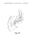 BODY CAVITY FOREIGN MATTER CAPTURE INSTRUMENT diagram and image