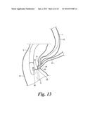 BODY CAVITY FOREIGN MATTER CAPTURE INSTRUMENT diagram and image