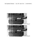 BODY CAVITY FOREIGN MATTER CAPTURE INSTRUMENT diagram and image