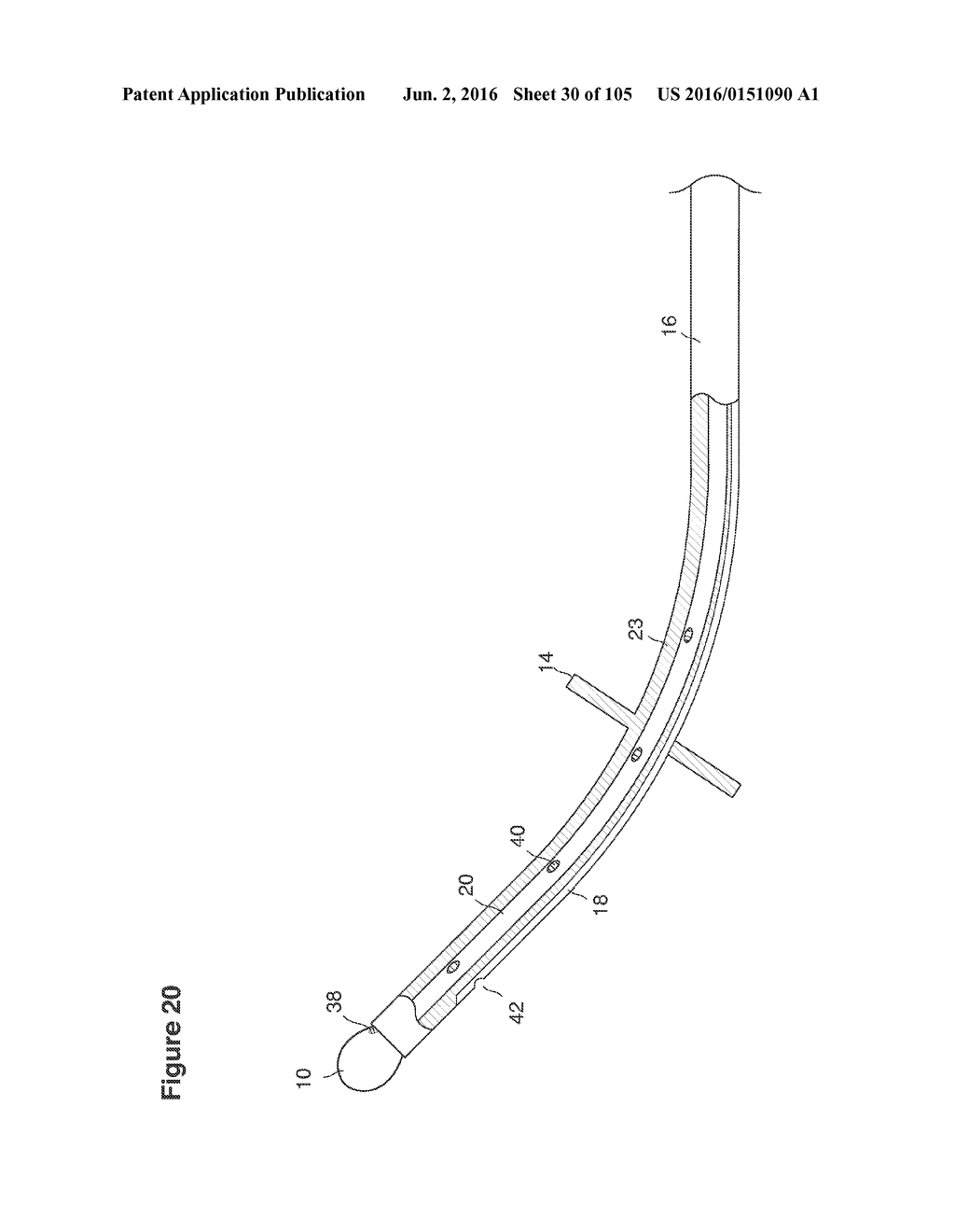 RECOVERY AND PROCESSING OF HUMAN EMBRYOS FORMED IN VIVO - diagram, schematic, and image 31