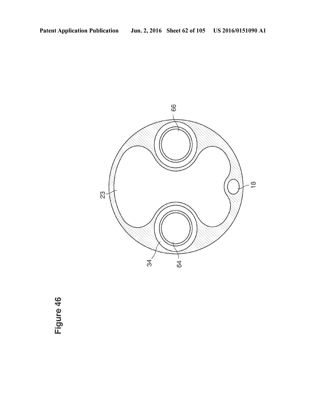 RECOVERY AND PROCESSING OF HUMAN EMBRYOS FORMED IN VIVO - diagram, schematic, and image 63