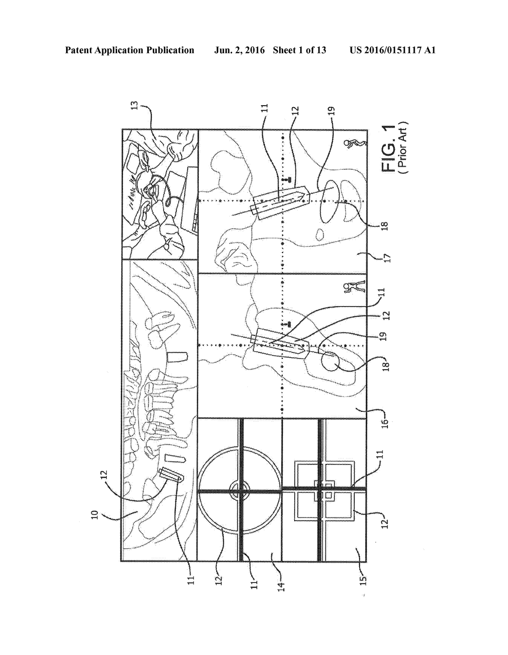 Visual Guidance Display For Surgical Procedure - diagram, schematic, and image 02