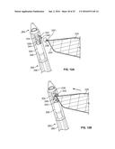 METHODS OF USING DELIVERY SYSTEMS FOR THE PLACEMENT OF SURGICAL IMPLANTS diagram and image