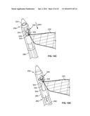 METHODS OF USING DELIVERY SYSTEMS FOR THE PLACEMENT OF SURGICAL IMPLANTS diagram and image