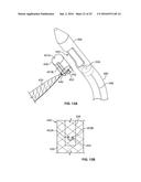 METHODS OF USING DELIVERY SYSTEMS FOR THE PLACEMENT OF SURGICAL IMPLANTS diagram and image