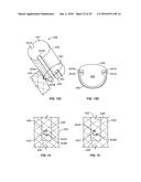 METHODS OF USING DELIVERY SYSTEMS FOR THE PLACEMENT OF SURGICAL IMPLANTS diagram and image