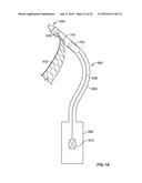 METHODS OF USING DELIVERY SYSTEMS FOR THE PLACEMENT OF SURGICAL IMPLANTS diagram and image