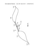 METHODS OF USING DELIVERY SYSTEMS FOR THE PLACEMENT OF SURGICAL IMPLANTS diagram and image