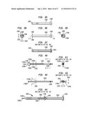 INTERVERTEBRAL SPACER DEVICE HAVING RECESSED NOTCH PAIRS FOR MANIPULATION     USING A SURGICAL TOOL diagram and image