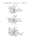 INTERVERTEBRAL SPACER DEVICE HAVING RECESSED NOTCH PAIRS FOR MANIPULATION     USING A SURGICAL TOOL diagram and image