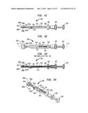 INTERVERTEBRAL SPACER DEVICE HAVING RECESSED NOTCH PAIRS FOR MANIPULATION     USING A SURGICAL TOOL diagram and image