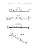 INTERVERTEBRAL SPACER DEVICE HAVING RECESSED NOTCH PAIRS FOR MANIPULATION     USING A SURGICAL TOOL diagram and image