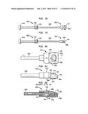 INTERVERTEBRAL SPACER DEVICE HAVING RECESSED NOTCH PAIRS FOR MANIPULATION     USING A SURGICAL TOOL diagram and image