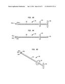 INTERVERTEBRAL SPACER DEVICE HAVING RECESSED NOTCH PAIRS FOR MANIPULATION     USING A SURGICAL TOOL diagram and image