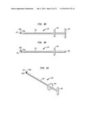 INTERVERTEBRAL SPACER DEVICE HAVING RECESSED NOTCH PAIRS FOR MANIPULATION     USING A SURGICAL TOOL diagram and image