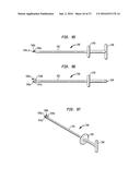 INTERVERTEBRAL SPACER DEVICE HAVING RECESSED NOTCH PAIRS FOR MANIPULATION     USING A SURGICAL TOOL diagram and image