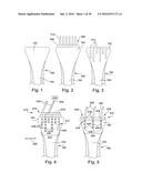 METHODS AND DEVICES FOR BONE PREPARATION diagram and image