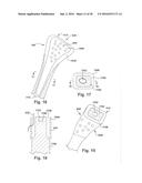 METHODS AND DEVICES FOR BONE PREPARATION diagram and image