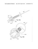 METHODS AND DEVICES FOR BONE PREPARATION diagram and image