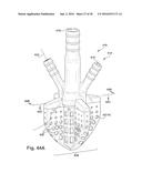 METHODS AND DEVICES FOR BONE PREPARATION diagram and image