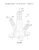 METHODS AND DEVICES FOR BONE PREPARATION diagram and image