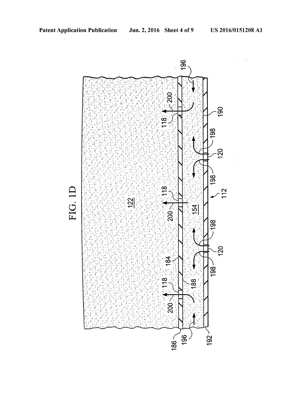 OPEN-CAVITY, REDUCED-PRESSURE TREATMENT DEVICES AND SYSTEMS - diagram, schematic, and image 05